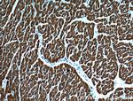 Myosin Light Chain 2 Antibody in Immunohistochemistry (Paraffin) (IHC (P))