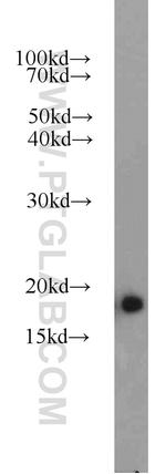 Myosin Light Chain 2 Antibody in Western Blot (WB)