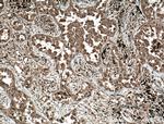 MYL3 Antibody in Immunohistochemistry (Paraffin) (IHC (P))