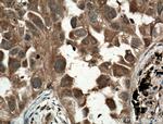 MYL3 Antibody in Immunohistochemistry (Paraffin) (IHC (P))