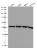 ARP2 Antibody in Western Blot (WB)