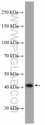 ARP2 Antibody in Western Blot (WB)