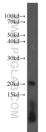 ARPC4 Antibody in Western Blot (WB)