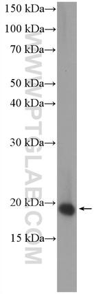 ARPC4 Antibody in Western Blot (WB)