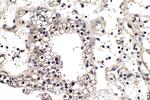 Cyclin D2 Antibody in Immunohistochemistry (Paraffin) (IHC (P))