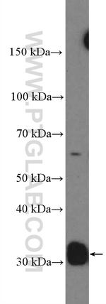 Cyclin D2 Antibody in Western Blot (WB)
