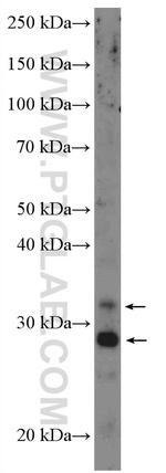 Cathepsin L Antibody in Western Blot (WB)