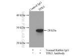TPK1 Antibody in Immunoprecipitation (IP)