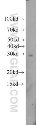 TPK1 Antibody in Western Blot (WB)