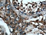 ARL3 Antibody in Immunohistochemistry (Paraffin) (IHC (P))