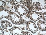 ARL3 Antibody in Immunohistochemistry (Paraffin) (IHC (P))