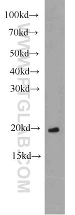 ARL3 Antibody in Western Blot (WB)