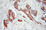 CDC34 Antibody in Immunohistochemistry (Paraffin) (IHC (P))