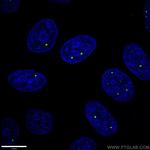 Coilin Antibody in Immunocytochemistry (ICC/IF)