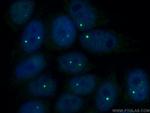 Coilin Antibody in Immunocytochemistry (ICC/IF)