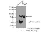 Coilin Antibody in Immunoprecipitation (IP)