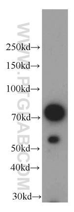 Coilin Antibody in Western Blot (WB)