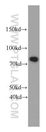 Coilin Antibody in Western Blot (WB)