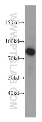 Coilin Antibody in Western Blot (WB)