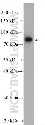 Coilin Antibody in Western Blot (WB)