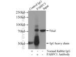 PABPC1/PABP Antibody in Immunoprecipitation (IP)