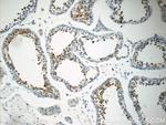 PABPC1/PABP Antibody in Immunohistochemistry (Paraffin) (IHC (P))