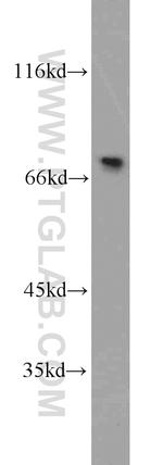 PABPC1/PABP Antibody in Western Blot (WB)