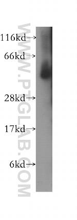 Fc epsilon RI alpha Antibody in Western Blot (WB)