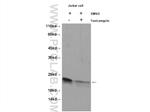 BID Antibody in Western Blot (WB)