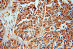 FHL1 Antibody in Immunohistochemistry (Paraffin) (IHC (P))