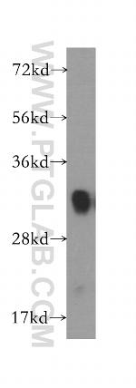 FHL1 Antibody in Western Blot (WB)