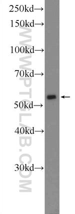 POLG2 Antibody in Western Blot (WB)