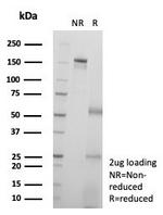 KIF2C (Kinesin Family Member 2C)/MCAK Antibody in SDS-PAGE (SDS-PAGE)