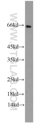 CDK5RAP3 Antibody in Western Blot (WB)