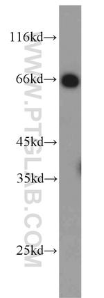 CDK5RAP3 Antibody in Western Blot (WB)
