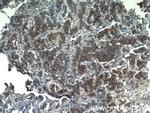 Midkine Antibody in Immunohistochemistry (Paraffin) (IHC (P))