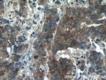 Midkine Antibody in Immunohistochemistry (Paraffin) (IHC (P))