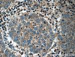 Midkine Antibody in Immunohistochemistry (Paraffin) (IHC (P))