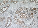 Midkine Antibody in Immunohistochemistry (Paraffin) (IHC (P))