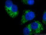 GABARAPL1 Antibody in Immunocytochemistry (ICC/IF)