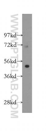 FATP4 Antibody in Western Blot (WB)