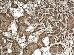 CDK4 Antibody in Immunohistochemistry (Paraffin) (IHC (P))