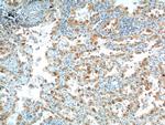 CDK4 Antibody in Immunohistochemistry (Paraffin) (IHC (P))