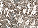 CDK4 Antibody in Immunohistochemistry (Paraffin) (IHC (P))