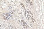 CDK4 Antibody in Immunohistochemistry (Paraffin) (IHC (P))