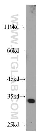 CDK4 Antibody in Western Blot (WB)