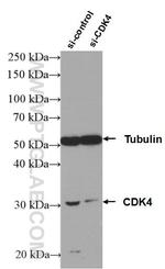 CDK4 Antibody in Western Blot (WB)