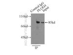 PLOD3 Antibody in Immunoprecipitation (IP)