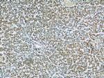 Transketolase Antibody in Immunohistochemistry (Paraffin) (IHC (P))