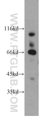 Transketolase Antibody in Western Blot (WB)